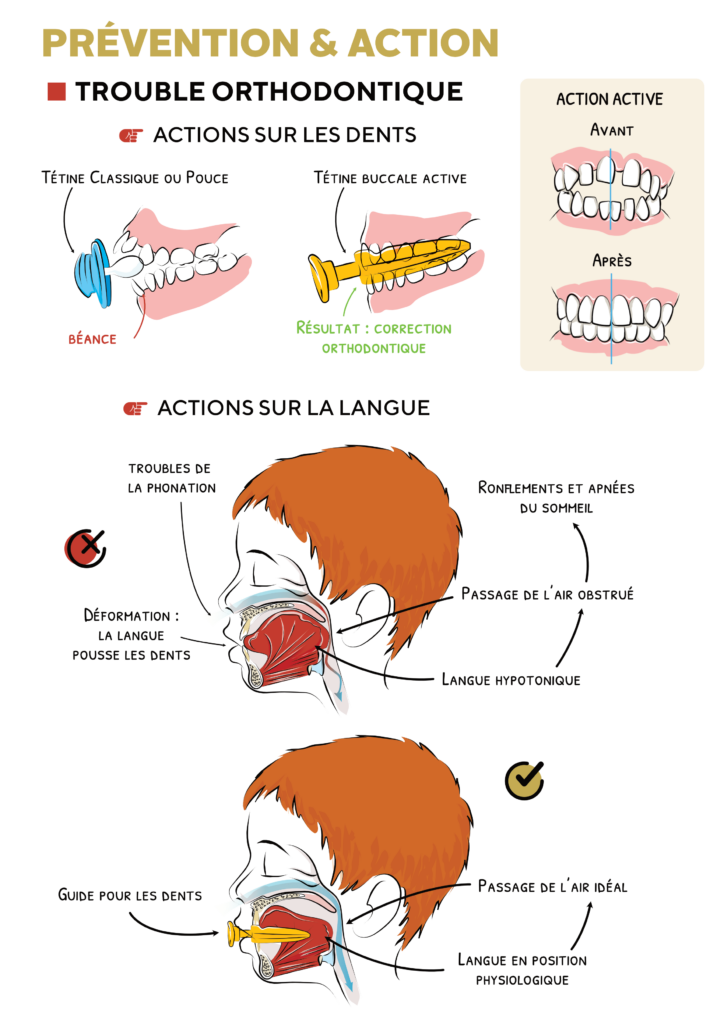 Compensations orales possibles lors du stop tétine