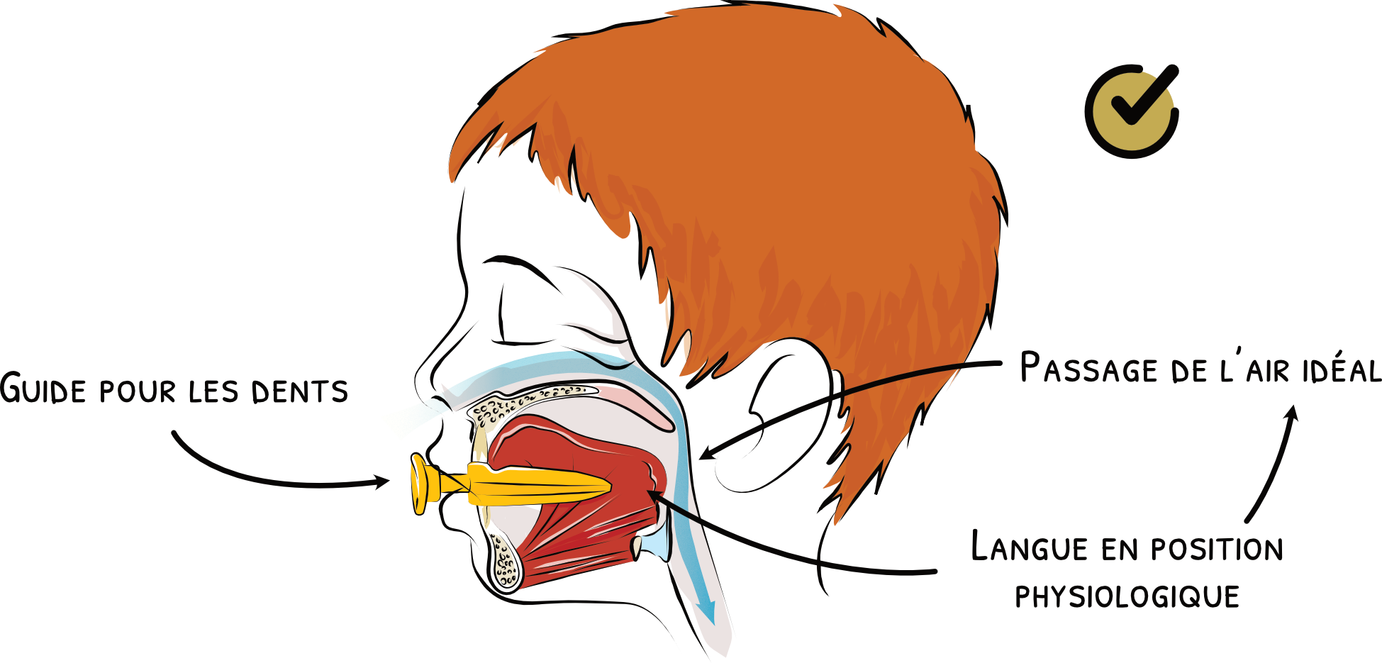 Tétine classique et pouce pouvant perturber le développement oro-facial