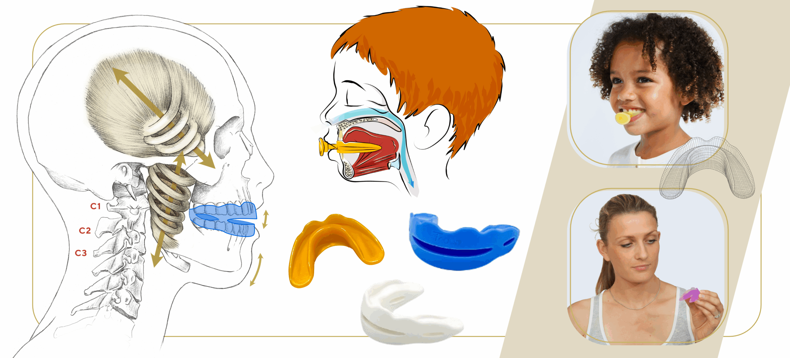 Gouttières posturales actives, matériel de rééducation Kinépod